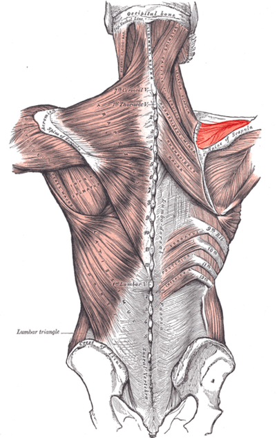 Totator Cuff Tendinosis