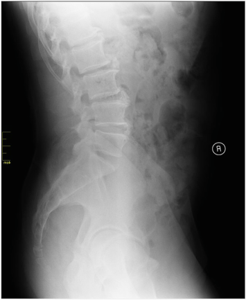 Pain From Degenerative Arthritis And The Relationship To Diagnostic 