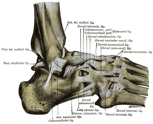 sprained ankle