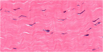Normal Connective Tissue Fascia