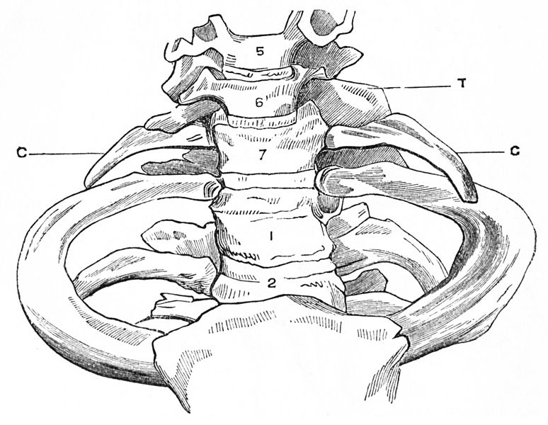 Cervical Rib