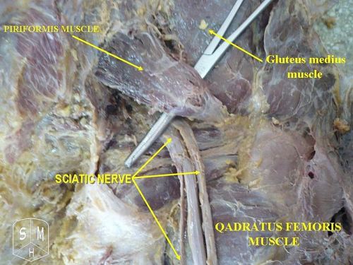 Sciatic Nerve Piriformis Muscle