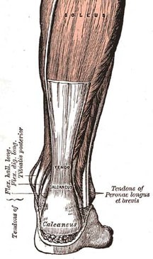Achilles Tendinosis
