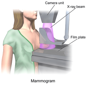 Mammography Death