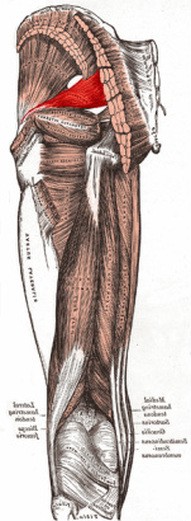 How Common is Piriformis Syndrome?