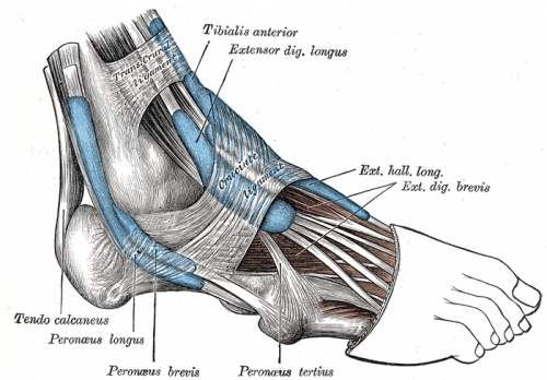 Ankle Tendinosis