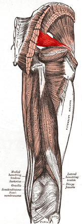 Piriformis Syndrome Self Help