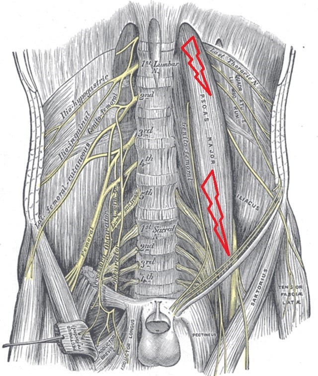 Trigger Points, Chronic Pain and Central Sensitization